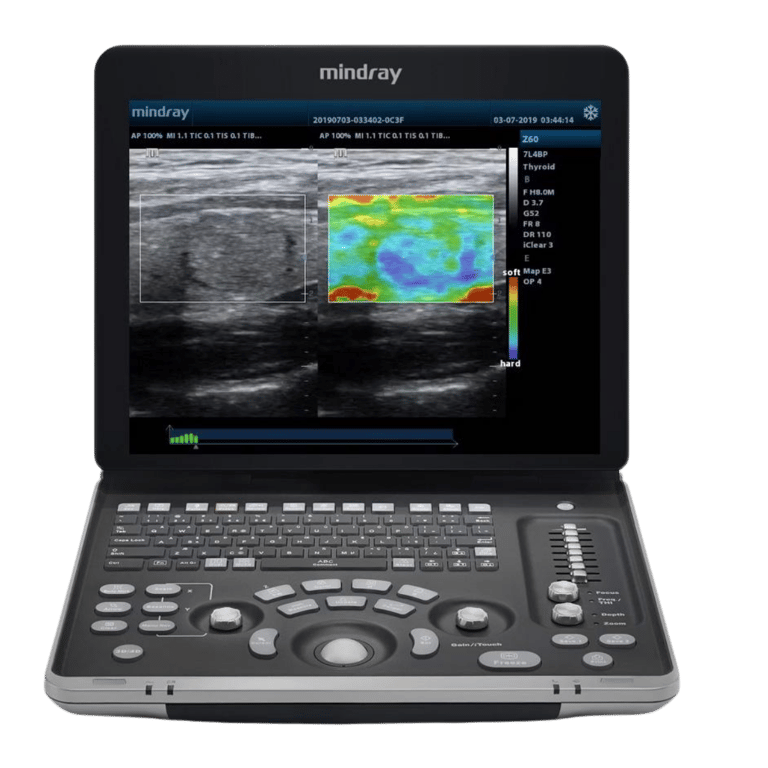 Mindray DP 50