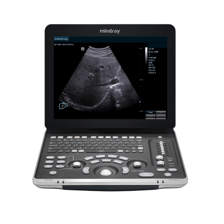 Mindray DP 60